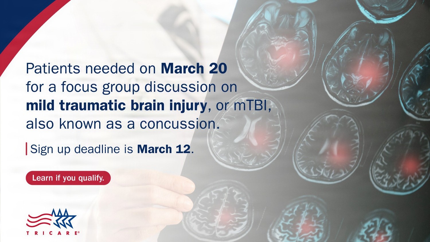 Patients needed on March 20 for a focus group discussion on mild traumatic brain injury, or mTBI, also known as a concussion. Sign up deadline is March 12. 