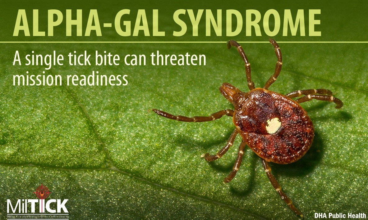 Alpha-Gal Syndrome is an unusual, sugar-triggered allergy initiated by the bite of the Lone Star tick and poses a unique threat to military readiness. To combat this threat, the Defense Health Agency-Public Health at Aberdeen Proving Ground, Maryland, is leveraging advanced vector surveillance, cutting-edge tick testing, and targeted nutritional strategies to protect service members and their families. (Defense Health Agency-Public Health graphic illustration by Rachel Stershic)