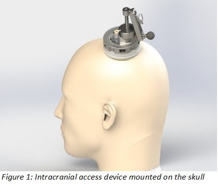 Intracranial access device mounted on the skull. (Photo courtesy of HJF)